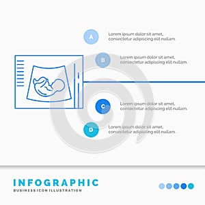 Maternity, pregnancy, sonogram, baby, ultrasound Infographics Template for Website and Presentation. Line Blue icon infographic