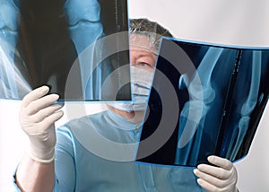 Mature doctor examining X-ray image photo