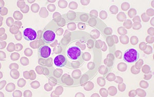 Mature lymphocyte on red blood cells background