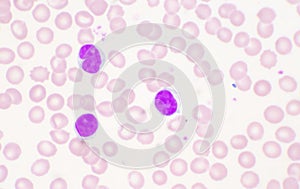 Mature lymphocyte on red blood cells background