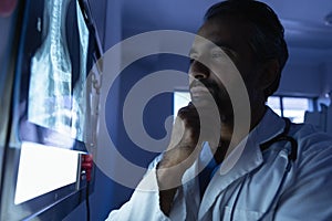 Mature male doctor looking at x-ray on x-ray light box in operation room at hospital