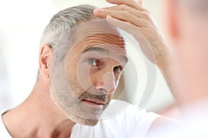 Mature man looking at hair loss photo