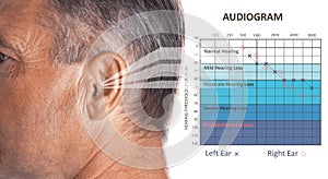 Mature man with symptom of hearing loss