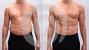 Mature Man Before And After Weight Loss On White Background