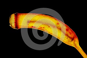 Mature moss sporangium in polarized light