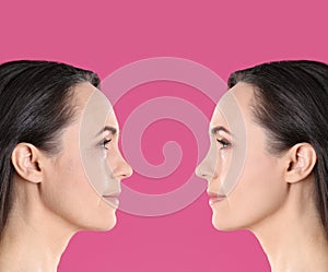 Mature woman before and after cosmetic procedure on background