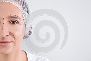 Mature woman with marks on face preparing for cosmetic surgery against white background, closeup.