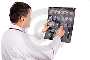 Matured Asian neurology medical doctor examining head MRI images