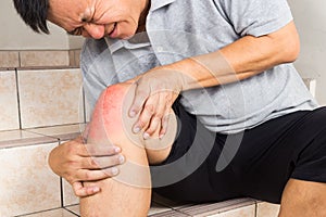 Matured man suffering painful knee joint seated on steps