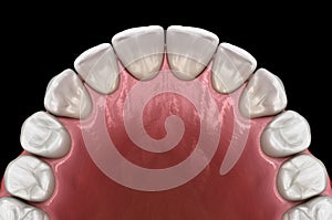 Maxillary human gum and teeth. Medically accurate tooth illustration