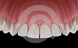Maxillary human gum and teeth. Medically accurate tooth illustration