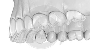 Maxillary human gum and teeth in white style. Medically accurate tooth illustration