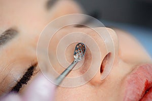 Mechanical cleaning of the face around the nose patient spa salon using an extractor