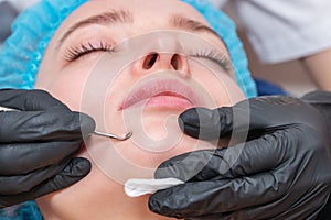 Mechanical cleaning of the face with extractor
