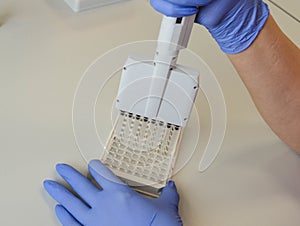 Mechanical dispenser for performing laboratory tests. tips for performing blood tests. setting up material for performing tests by