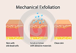 Mechanical exfoliation or peeling, vector illustration on light background