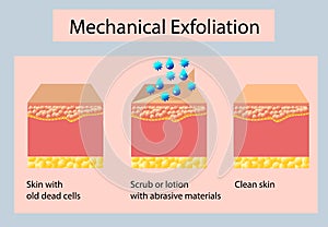 Mechanical exfoliation or peeling, vector illustration on light background