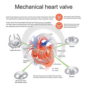 Mechanical heart valve. Vector, Illustration Design. photo