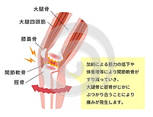 Mechanism and causes of knee joint pain / Japanese