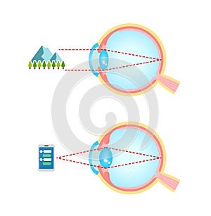 Mechanism of eyeball for looking far and near illustration