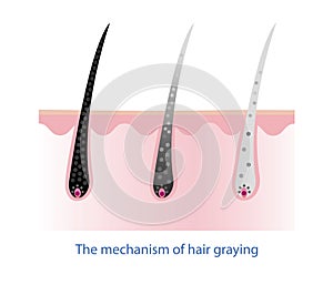 The mechanism of hair graying vector on white background.