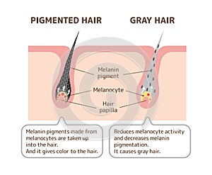 Mechanism of pigmented hair and gray hair / comparison vector illustration