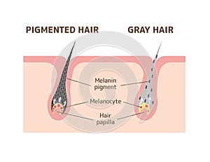 Mechanism of pigmented hair and gray hair / comparison vector illustration