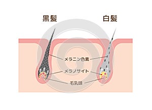 Mechanism of pigmented hair and gray hair / comparison vector illustration / Japanese