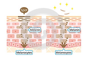 Mechanism of skin cell turnover illustration. melanin and melanocyte in human skin layer. beauty and skin care concept