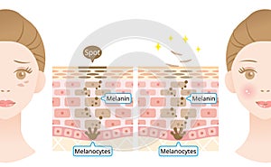 Mechanism of skin cell turnover illustration. Melanin and melanocytes in human skin layer with woman face. beauty and skin care photo