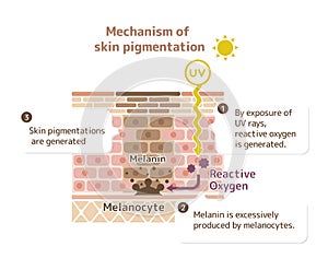 Mechanism of skin pigmentation illustration