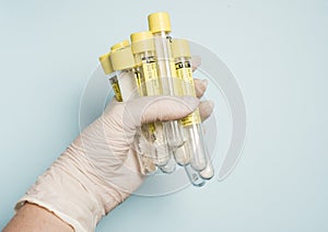 Medecin test tubes for labaroth studies and blood tests.Medical equipment.