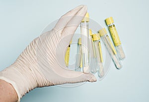 Medecin test tubes for labaroth studies and blood tests.Medical equipment.