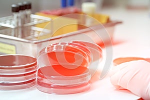 Media plate on table of medical technicians working on bacterial