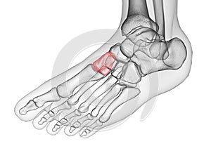 The medial cuneiform bone