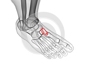 the medial cuneiform bone