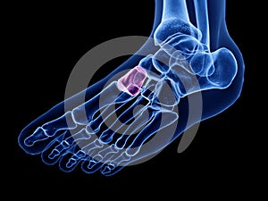the medial cuneiform bone