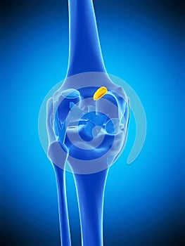 The medial gastrocnemius bursa