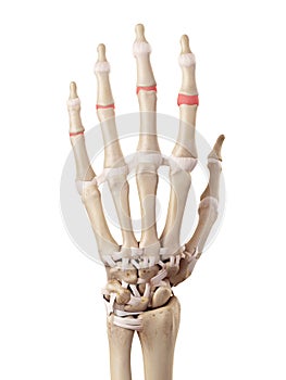 The medial joint capsules