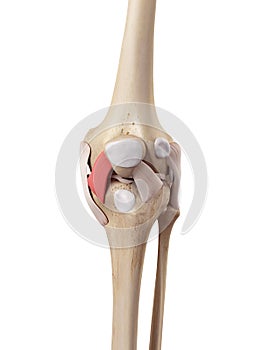 The medial patellar ligament photo