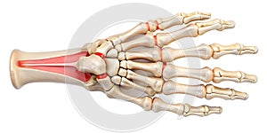 Medial view of carpometacarpal joint of little finger x-ray photo