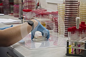 a medic with a hand manipulates a petri dish to collect data for analysis