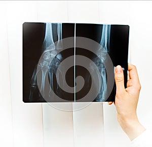 Medic holding roentgen