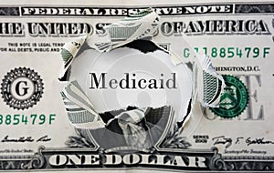 Medicaid costs