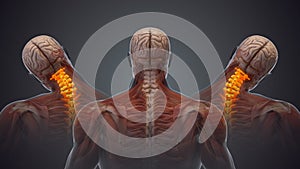 Medical animation for neck pain
