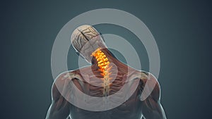 Medical animation for neck pain