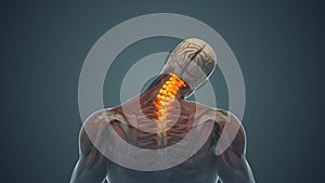 Medical animation for neck pain