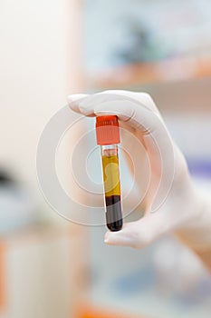 Medical blood test in tubes. Hand holding blood in test tube.