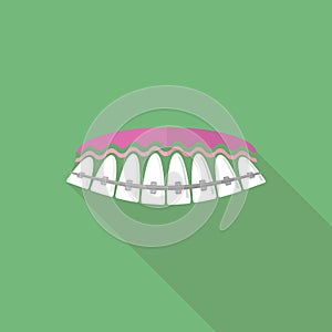 Medical Braces Teeth. Dental Care Background. Orthodontic Treatment.