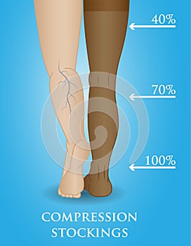 Medical compression hosiery